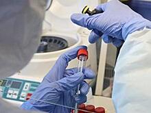 В Костромской области за сутки выявлено 48 случаев COVID-19